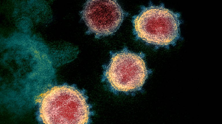 Das Coronavirus SARS-CoV-2, das Covid-19 verursacht, unter dem Mikroskop  (Foto: dpa Bildfunk, Das Coronavirus SARS-CoV-2, das Covid-19 verursacht, unter dem Mikroskop )