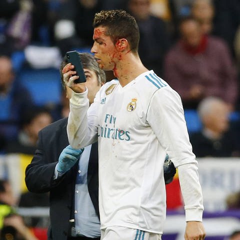 Cristiano Ronaldo (Foto: IMAGO, Marca)
