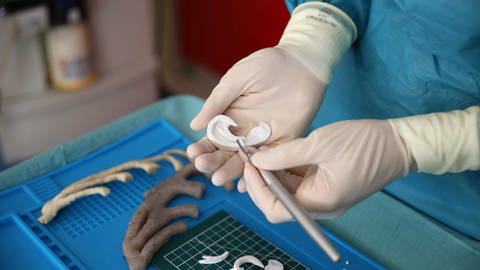 Der Arzt Flavio Facchini hält in der Klinik Al Meyer einen nach einem 3D-Modell geschaffenen Ohrmuschel-Ersatz aus Knorpel in der Hand. (Foto: dpa Bildfunk, picture alliance/dpa/Klinik Al Meyer | -)