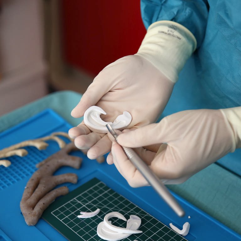 Der Arzt Flavio Facchini hält in der Klinik Al Meyer einen nach einem 3D-Modell geschaffenen Ohrmuschel-Ersatz aus Knorpel in der Hand. (Foto: dpa Bildfunk, picture alliance/dpa/Klinik Al Meyer | -)
