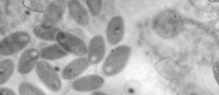 Zu sehen ist ein Virus unter einem Mikroskop in schwarz weiß (Foto: DASDING)