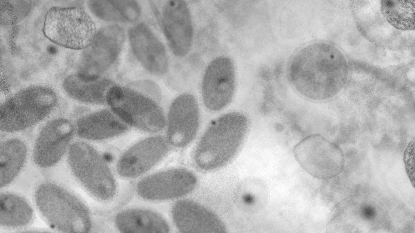 Zu sehen ist ein Virus unter einem Mikroskop in schwarz weiß