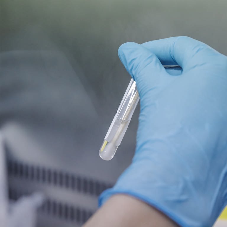 Eine Krankenschwester einen PCR-Test zur Erkennung des Affenpockenvirus durch. (Foto: picture-alliance / Reportdienste, picture alliance/dpa/EUROPA PRESS | Carlos Luján)