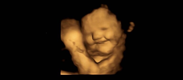 Baby lächelt auf 4D-Ultraschallbild im Mutterleib. (Foto: FETAP Study / Fetal and Neonatal Research Lab / Durham University)