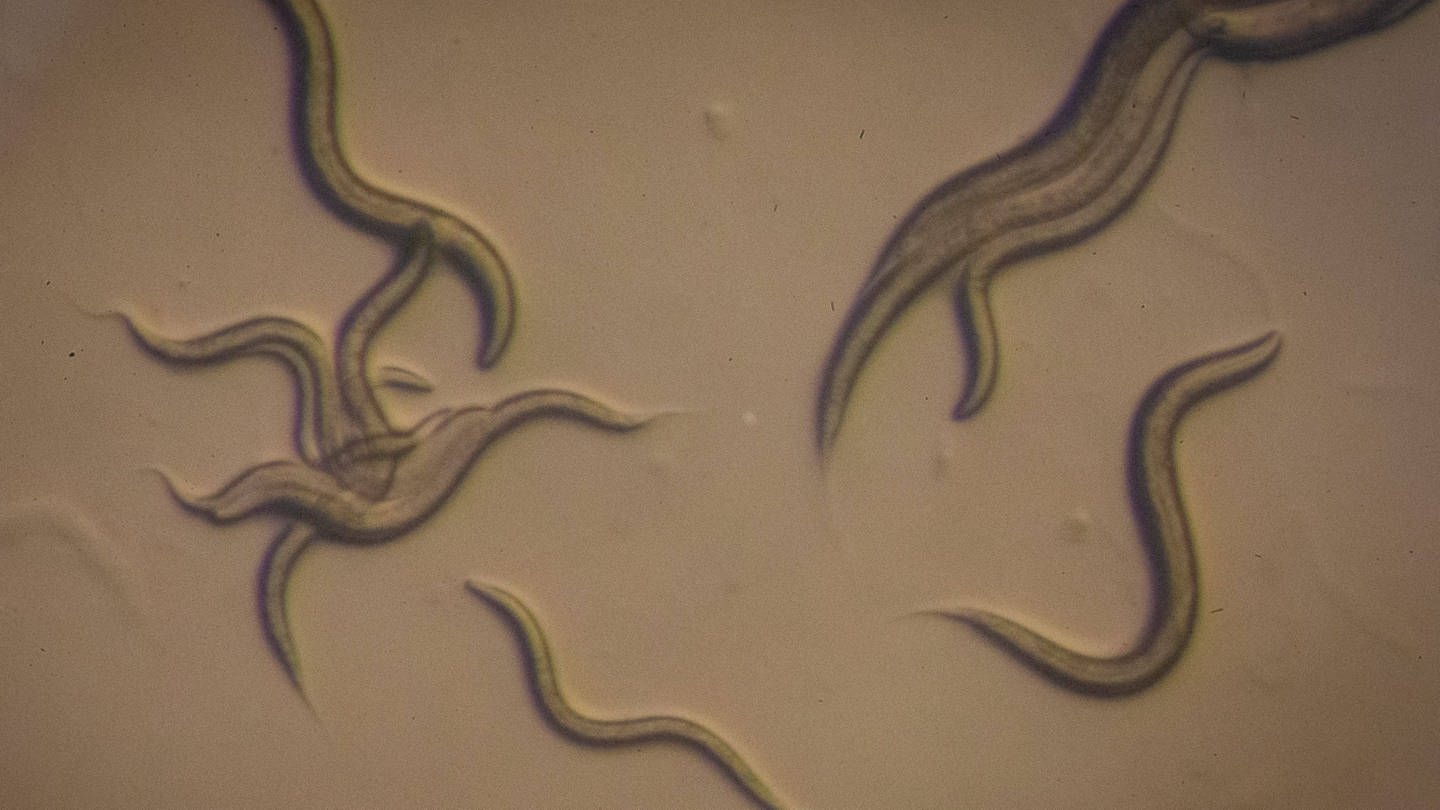 Fadenwürmer unter dem Mikroskop (Foto: IMAGO, xBenxLonergan/ThexRegister-Guardx 20556537)